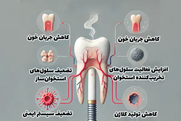 تاثیر سیگار بر ایمپلنت