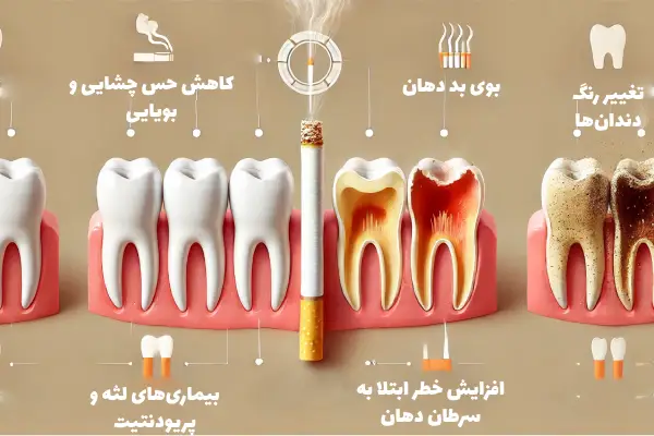 تاثیر سیگار بر ایمپلنت