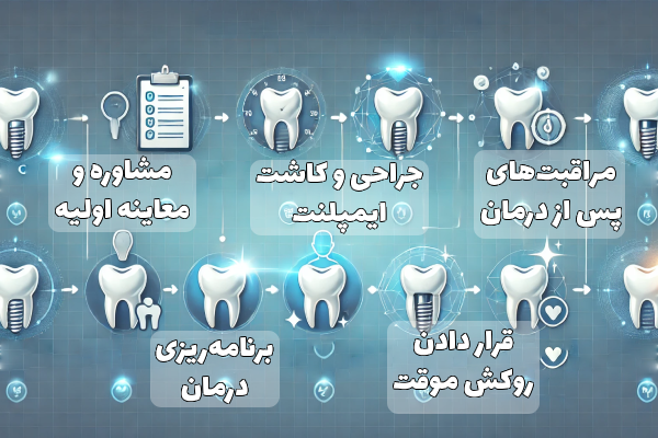 ایمپلنت فوری