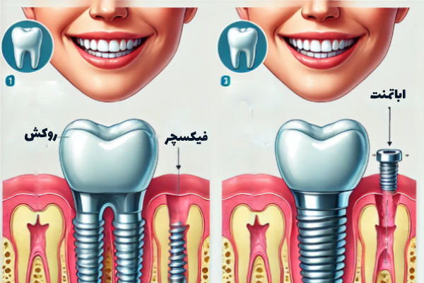 تفاوت بین اسلیو و بای پس معده